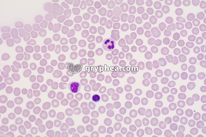 Sang humain x200 - gryphea.org